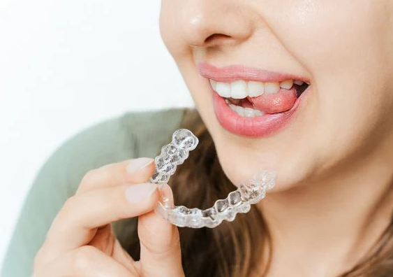 Clear Aligners London Ontario: A Modern Way to Straighten Your Smile