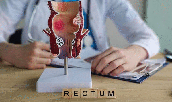 Modern Relief Options for Long Lasting Hemorrhoid Care Today